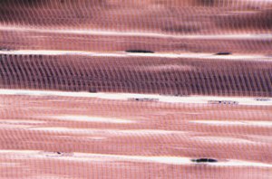 Skeletal Muscle Cells